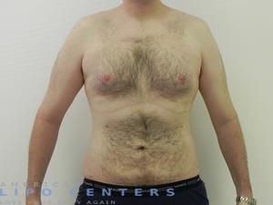 americanlipocenters_108.jpg